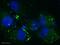 Collagen alpha-2(VI) chain antibody, ab6588, Abcam, Immunofluorescence image 