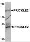 Prickle-like protein 2 antibody, 6563, ProSci, Western Blot image 
