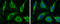 Hexokinase 3 antibody, GTX111409, GeneTex, Immunofluorescence image 