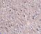 Cell Death Inducing P53 Target 1 antibody, PA5-20692, Invitrogen Antibodies, Immunohistochemistry frozen image 