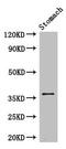 Pim-3 Proto-Oncogene, Serine/Threonine Kinase antibody, CSB-PA771444LA01HU, Cusabio, Western Blot image 