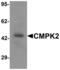 Cytidine/Uridine Monophosphate Kinase 2 antibody, LS-B8875, Lifespan Biosciences, Western Blot image 