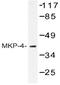 Dual Specificity Phosphatase 9 antibody, AP20456PU-N, Origene, Western Blot image 
