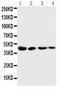 Cystathionine Gamma-Lyase antibody, PA1556, Boster Biological Technology, Western Blot image 