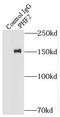 PHD Finger Protein 2 antibody, FNab06384, FineTest, Immunoprecipitation image 