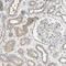 Sorting Nexin 29 antibody, PA5-52623, Invitrogen Antibodies, Immunohistochemistry paraffin image 