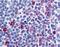 C-C chemokine receptor type 8 antibody, NLS359, Novus Biologicals, Immunohistochemistry frozen image 