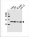 Ubiquitin Conjugating Enzyme E2 K antibody, TA324679, Origene, Western Blot image 