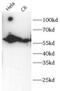 Keratin 6A antibody, FNab10735, FineTest, Western Blot image 