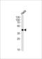 MAPK Activated Protein Kinase 3 antibody, LS-C164476, Lifespan Biosciences, Western Blot image 