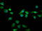 Rho GTPase-activating protein 15 antibody, LS-C680176, Lifespan Biosciences, Immunofluorescence image 