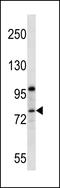 Protein Phosphatase 1 Regulatory Subunit 15B antibody, LS-C162106, Lifespan Biosciences, Western Blot image 