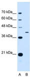 SRBC antibody, TA339867, Origene, Western Blot image 