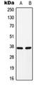 Glucagon antibody, orb213971, Biorbyt, Western Blot image 
