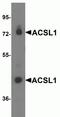 Acyl-CoA Synthetase Long Chain Family Member 1 antibody, NBP2-82060, Novus Biologicals, Western Blot image 
