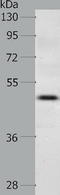 C-C Motif Chemokine Receptor 3 antibody, TA323965, Origene, Western Blot image 