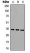 Cathepsin K antibody, LS-C354313, Lifespan Biosciences, Western Blot image 