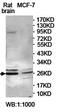 RAB4A, Member RAS Oncogene Family antibody, orb78154, Biorbyt, Western Blot image 