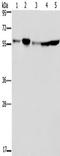 Nucleoporin 50 antibody, TA350245, Origene, Western Blot image 