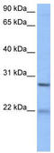 Epithelial Cell Transforming 2 antibody, TA340188, Origene, Western Blot image 