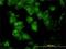 Glutamate-Cysteine Ligase Catalytic Subunit antibody, H00002729-M01, Novus Biologicals, Immunocytochemistry image 