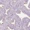Glutamate Rich 5 antibody, NBP1-93789, Novus Biologicals, Immunohistochemistry frozen image 