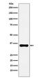 Homeobox A9 antibody, M00912, Boster Biological Technology, Western Blot image 
