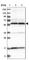 Protein Phosphatase 3 Catalytic Subunit Gamma antibody, HPA023396, Atlas Antibodies, Western Blot image 