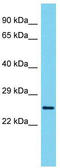 Variable charge X-linked protein 3 antibody, TA331913, Origene, Western Blot image 