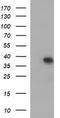 Malonyl-CoA-acyl carrier protein transacylase, mitochondrial antibody, CF507070, Origene, Western Blot image 