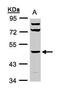 Hyaluronidase 1 antibody, PA5-27901, Invitrogen Antibodies, Western Blot image 