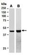 Lysine-specific demethylase 2A antibody, orb67176, Biorbyt, Western Blot image 