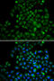 Fatty Acid Binding Protein 4 antibody, 13-092, ProSci, Immunofluorescence image 