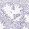 Pappalysin-2 antibody, HPA018412, Atlas Antibodies, Immunohistochemistry frozen image 