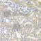 AU RNA Binding Methylglutaconyl-CoA Hydratase antibody, A7424, ABclonal Technology, Immunohistochemistry paraffin image 