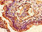 Histone Cluster 1 H1 Family Member E antibody, LS-C670381, Lifespan Biosciences, Immunohistochemistry paraffin image 