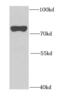 Galactosylceramidase antibody, FNab03305, FineTest, Western Blot image 