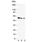 FCAR antibody, R30625, NSJ Bioreagents, Western Blot image 