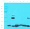 Sodium Channel Epithelial 1 Gamma Subunit antibody, orb389322, Biorbyt, Western Blot image 