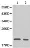 Dihydrofolate Reductase antibody, TA321198, Origene, Western Blot image 