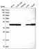 POTE Ankyrin Domain Family Member F antibody, HPA041264, Atlas Antibodies, Western Blot image 