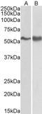 FYN Proto-Oncogene, Src Family Tyrosine Kinase antibody, LS-C20159, Lifespan Biosciences, Western Blot image 