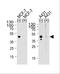 Calcitonin Receptor antibody, A03322-1, Boster Biological Technology, Western Blot image 
