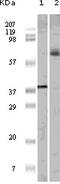ETS domain-containing protein Elk-1 antibody, M01426-1, Boster Biological Technology, Western Blot image 