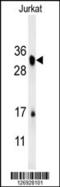 R-Spondin 4 antibody, 62-016, ProSci, Western Blot image 