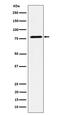Exocyst Complex Component 3 antibody, M08984-2, Boster Biological Technology, Western Blot image 