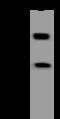 CDKN1A Interacting Zinc Finger Protein 1 antibody, 206434-T36, Sino Biological, Western Blot image 
