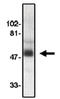 C-C Motif Chemokine Receptor 8 antibody, AP05102PU-N, Origene, Western Blot image 