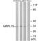 Mitochondrial Ribosomal Protein L19 antibody, PA5-49939, Invitrogen Antibodies, Western Blot image 