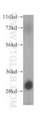 Peptidylprolyl Isomerase Like 6 antibody, 17452-1-AP, Proteintech Group, Western Blot image 